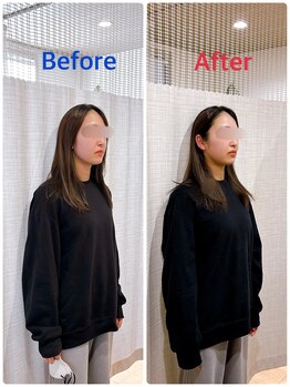 イズム まつもと店(izm)/小顔モニター様