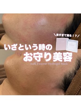 ジェノール 2nd beauty studio 姫路駅前店(JNOEL)/いざという時のお守り美容！