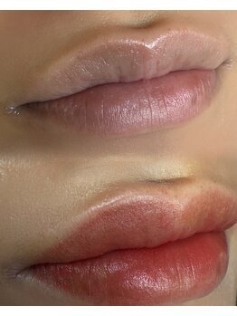 ライム 五反田(LIME)/ローマピンク|黒ずみケア