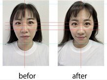 アオバダイ整体院/整体/小顔矯正/自律神経