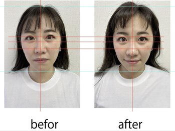 アオバダイ整体院/整体/小顔矯正/自律神経