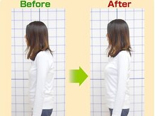 パドマラボ/パドマで施術後のbefore/after◎