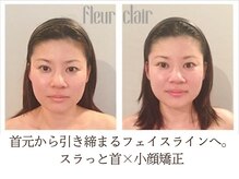 フルールクレール 日本橋店の雰囲気（【集中コースでしっかり改善】フルクレ式 美首小顔矯正3回）