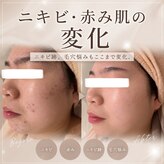 プリベンティブ ビューティー ティップス(Preventive Beauty Tips)