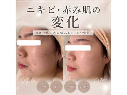 プリベンティブ ビューティー ティップス(Preventive Beauty Tips)の写真