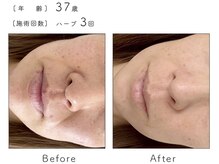 サロン バイオビオ(SALON BioBio)/