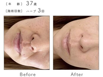 サロン バイオビオ(SALON BioBio)/