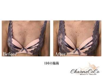 シャルムココ 蔵前店(CharmeCoCo)/お客様Before→After