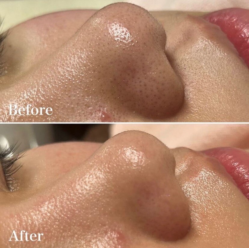 ラエッセ(LAESSE)｜ホットペッパービューティー