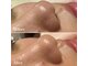 ラエッセ(LAESSE)の写真/【デコルテ&フェイシャルマッサージ付◎】セルフケアでは取りきれない皮脂汚れ・角栓をごっそり吸引！