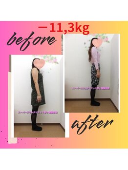 スーパースリムダイエット茅ヶ崎 茅ヶ崎整体院/3ヵ月－11,3ｋｇ減ダイエット♪