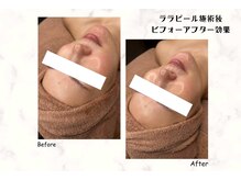 サロン ド マハロ(Salon de MAHALO)の雰囲気（話題の韓国LHALALAピーリング♪剥離無しでお肌を分厚く健康に◎）