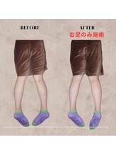 ヴィセル(VISEL)/