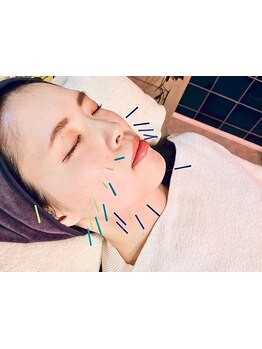 小顔になりたい