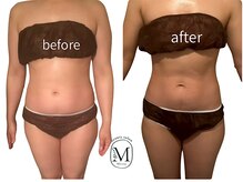 ミヨン(Miyong)/深部から温めスッキリボディへ♪