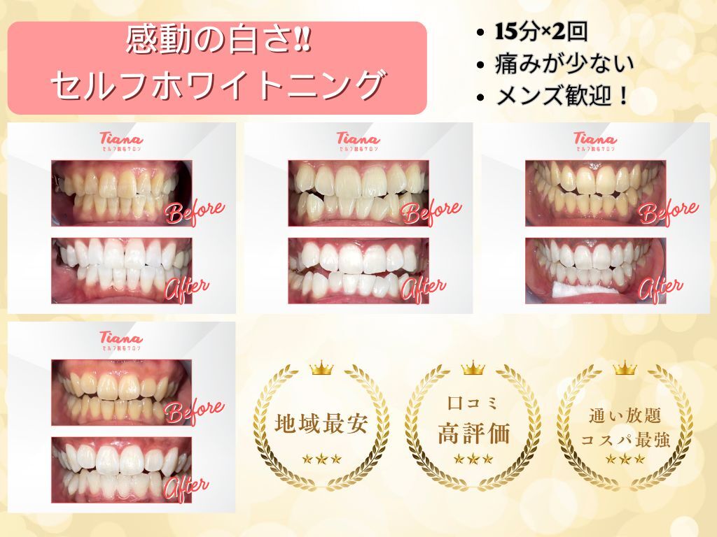 ティアナ 福岡香椎店(Tiana)｜ホットペッパービューティー