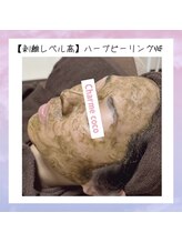 シャルム ココ 八尾店(Charme coco)/選べる剥離！ハーブピーリング♪