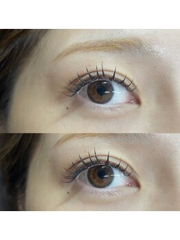 ビュー(V.I.E.W)/BINDLOCK140束