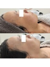 ヴェルシック(Belchic)/ファンデいらずの素肌になれる！