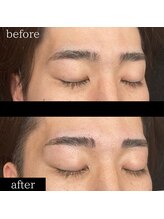 ユー 千葉駅前店(you)/ビフォーアフター写真