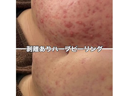 エヌハーブ(NHerb)の写真