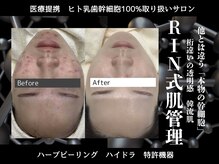 リンフェイス 表参道(RIN FACE)