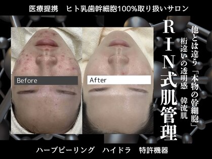 リンフェイス 表参道(RIN FACE)の写真