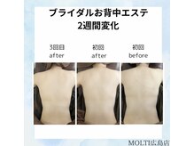 モルティー 広島店(Molti)/ブライダルエステ