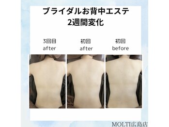 モルティー 広島店(Molti)/ブライダルエステ