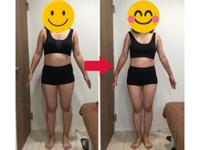 美容整体院元 光の森店/ 40代S.I様のビフォーアフター