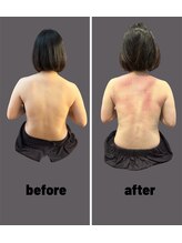 アリアグロウ(Aria Glow.)/猫背がまっすぐ美姿勢に！