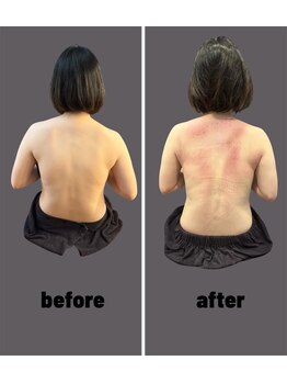 アリアグロウ(Aria Glow.)/猫背がまっすぐ美姿勢に!