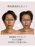 【満足度No. 1】3時間徹底★年齢顔、たるみのお悩みに全身からアプローチ★