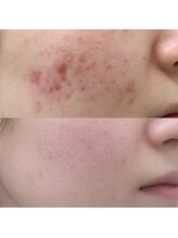 ソアン(Soin)/自信のあるお肌へ