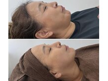 ジェニー(JENNI)の雰囲気（速攻性小顔矯正）