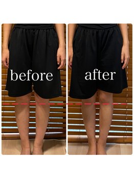 美容整体 綾/美脚や脚のお悩みにも◎