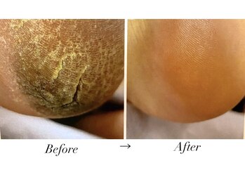 ルブラン(Lu'Bulan)/【最新韓国式エスプランニング】