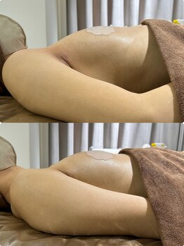 エレガンスアンドビューティー 船橋本店(Elegance&Beauty)/ブライダルエステにも♪