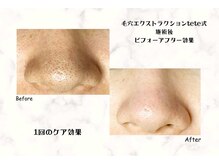 サロン ド マハロ(Salon de MAHALO)の雰囲気（毛穴悩みから肌質改善と小顔まで豊富なメニュー♪）