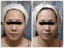 ティアス(t-us)/【肌育】タラソトリートメント