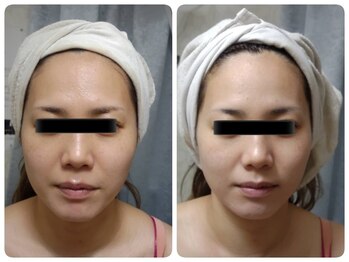 ティアス(t-us)/【肌育】タラソトリートメント