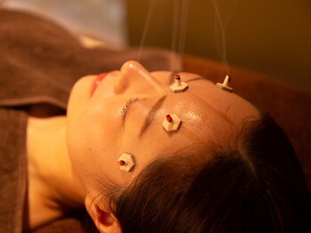 アルセア(ALCEA)/眠れる美容鍼