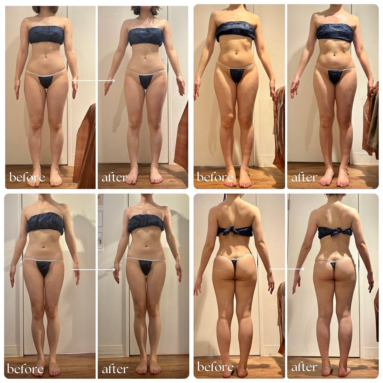 外苑前駅でエンダモロジーが人気のエステサロン｜ホットペッパー