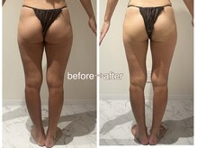 ラディアンスの雰囲気(【5回】痩せる方法を知れば理想のボディも夢じゃない♪)