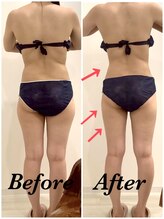 スペチアーレ 夙川/小顔と美ボディをGET