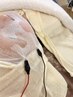 人気No.3【毛穴詰まり・ざらつき】肌質改善ピーリング＋ニキビ肌荒れ集中ケア