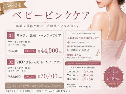 モンロー(MonroE+)の写真