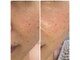 リッチベル(richbelle)の写真