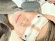 アリィ エステティック(allie esthetic)の写真/シミ・くすみ・ハリ不足が気になり始めた肌へ、当店人気No.１の光フェイシャルで本来の肌へ♪