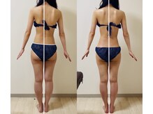 ブリス(Bliss)/◆筋膜リリースで骨格矯正も叶う